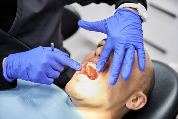 Best Emergency Broken Tooth Repair in State College, PA