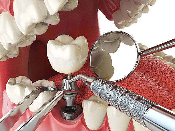 Best Emergency Orthodontic Repairs in State College, PA